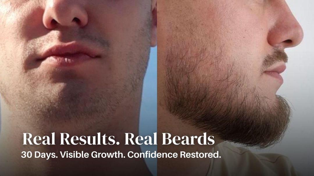 Before and after using beard growth kit