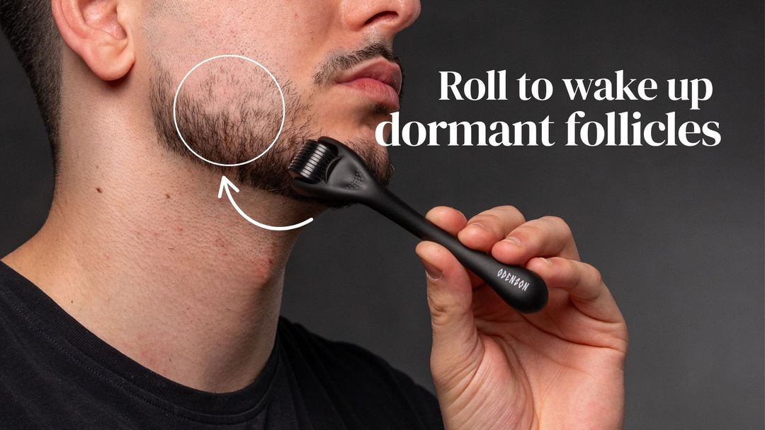 Using Beard Roller to stimulate patchy beard growth